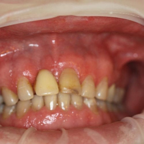 before cosmetic dentistry results by Paul F. Bowersox, DDS