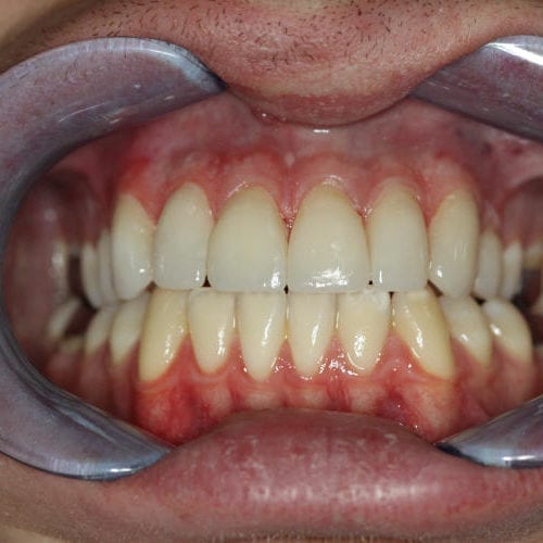 after cosmetic dentistry results by Paul F. Bowersox, DDS