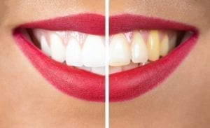 westminster, md cosmetic dentistry